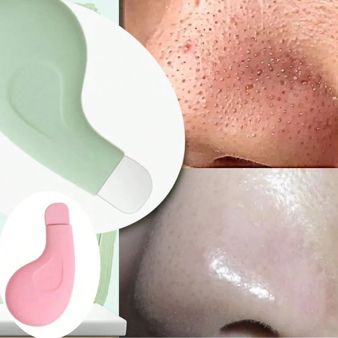 1/2pcs New Beauty Cleaning Nose Blackhead Remover, Deep Pore Cleansing Blackhead & Whitehead Removal Tool