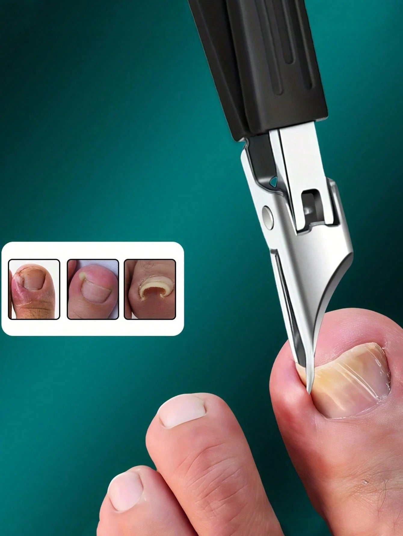 High Precision Nail Clipper For Thick Ingrown Nails, Made Of Premium Stainless Steel With Soft Handle And 25-Degree Ultra-Sharp Blade, Anti-Splatter Design For Elderly