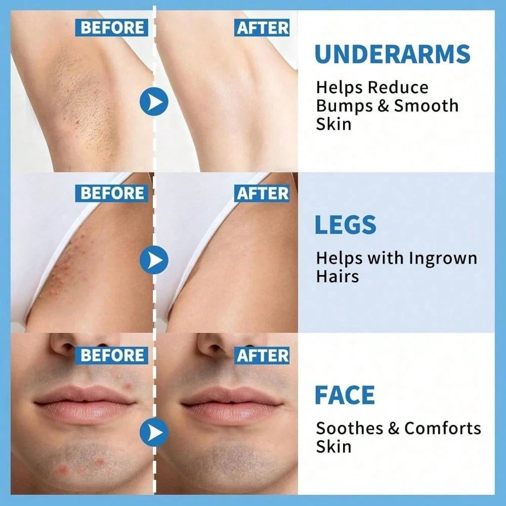 Smooth Repair Hair Regrowth Serum, Soothing Roll-On Serum After Hair Removal, Suitable For Men And Women, Soothes Sensitive Skin On Face, Underarms, And Bikini Area| Contains Salicylic Acid And Glyco