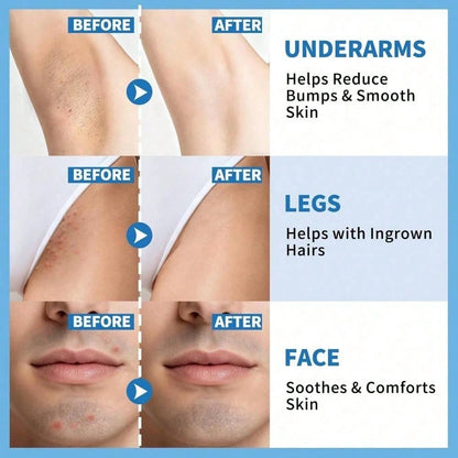 Smooth Repair Hair Regrowth Serum, Soothing Roll-On Serum After Hair Removal, Suitable For Men And Women, Soothes Sensitive Skin On Face, Underarms, And Bikini Area| Contains Salicylic Acid And Glyco