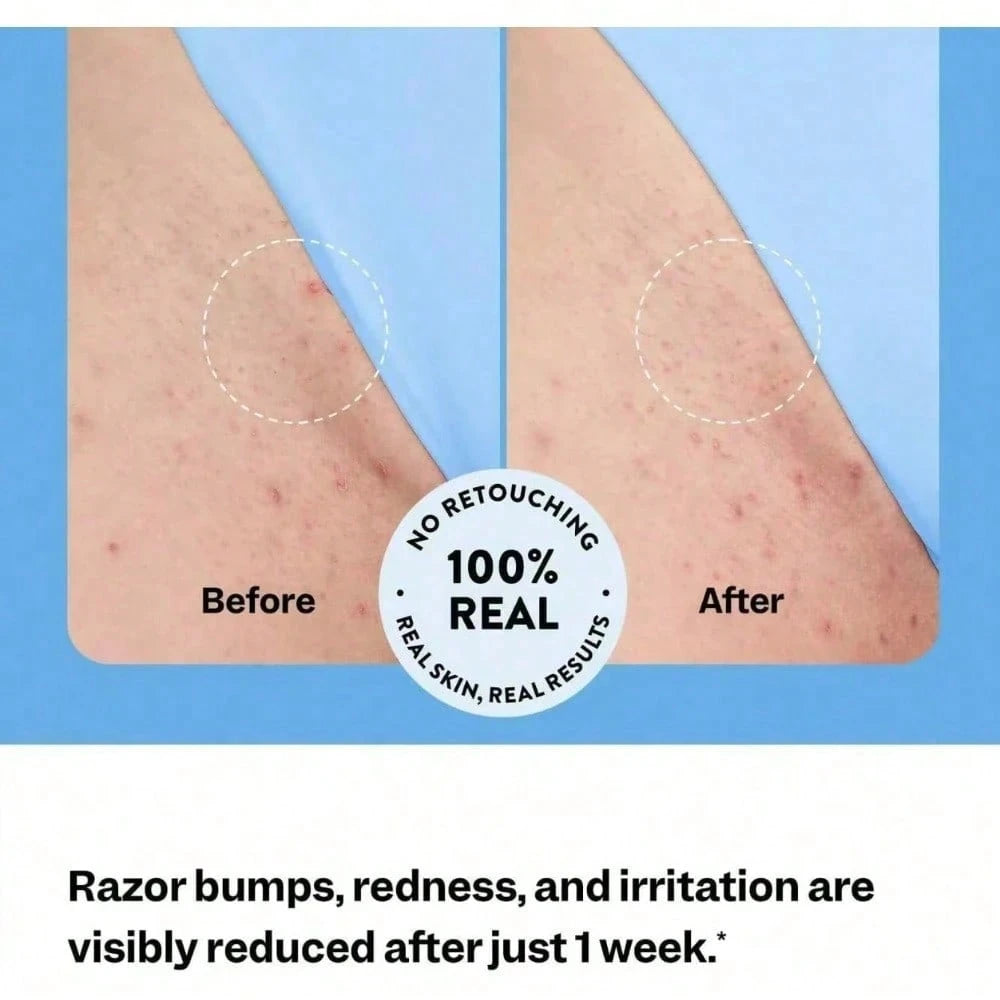 Smooth Repair Ingrown Hair Serum, Razor Bump Treatment, Suitable For Women And Men, Soothes And Calms Sensitive Skin On The Face, Underarms, And Bikini Area| Contains Salicylic Acid And Glycolic Acid